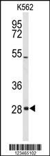 Anti-CLDN18 Rabbit Polyclonal Antibody