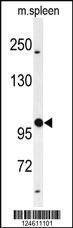 Anti-GALNT5 Rabbit Polyclonal Antibody [clone: 381CT18.5.1]