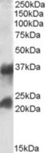 EB08878 (0.1 µg/ml) staining of Human Frontal Cortex lysate (35 µg protein in RIPA buffer). Primary incubation was 1 hour. Detected by chemiluminescence.