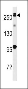 Anti-LRRK2 Rabbit Polyclonal Antibody (HRP (Horseradish Peroxidase))