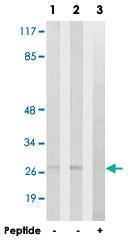 Anti-NPDC1 Rabbit Polyclonal Antibody