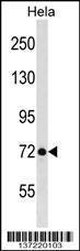 Anti-LAS1L Rabbit Polyclonal Antibody (HRP (Horseradish Peroxidase))