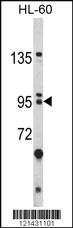 Anti-BICC1 Rabbit Polyclonal Antibody