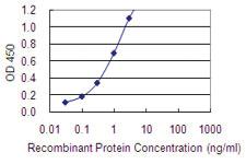 Anti-MAGEA2 Mouse Monoclonal Antibody [clone: 1H4]