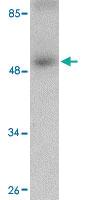 Anti-SCARA5 Rabbit Polyclonal Antibody