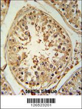 Anti-ZBTB5 Rabbit Polyclonal Antibody (FITC (Fluorescein Isothiocyanate))