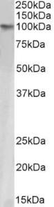 Anti-TRIM28 Antibody (A84309) (1 µg/ml) staining HeLa nuclear lysate (35 µg protein in RIPA buffer). Primary incubation was 1 hour. Detected by chemiluminescence