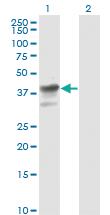 Anti-MAPK3 Mouse Monoclonal Antibody [clone: 1F7]