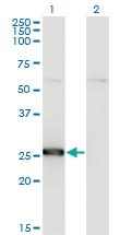 Anti-TK1 Mouse Monoclonal Antibody [clone: 1D10]