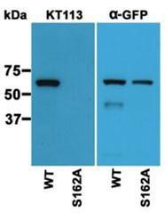 Western blotting using lysates of HEK cells expressing wild type EB3 (WT, most S162 was phosphorylated) and none phosphorylated EB3 (S162A)