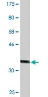 Anti-DDB2 Mouse Monoclonal Antibody [clone: 1F11]