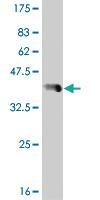 Anti-FOXO3 Mouse Monoclonal Antibody [clone: 3C2]