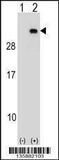 Anti-PGRMC2 Rabbit Polyclonal Antibody (AP (Alkaline Phosphatase))