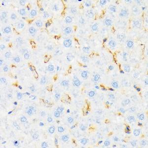 Immunohistochemistry analysis of paraffin-embedded rat liver using Anti-CSK Antibody [ARC1835] (A307712) at a dilution of 1:100 (40x lens). Perform microwave antigen retrieval with 10 mM Tris/EDTA buffer pH 9.0 before commencing with IHC staining protocol.