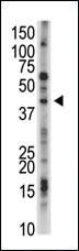 Anti-USP12 Rabbit Polyclonal Antibody