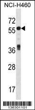 Anti-ICA1 Rabbit Polyclonal Antibody