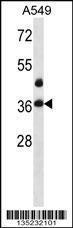 Anti-LASP1 Rabbit Polyclonal Antibody (APC (Allophycocyanin))