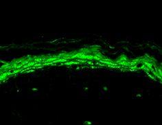 Immunohistochemistry analysis of mouse backskin, fixed in Bouin's fixative solution and paraffin-embedded