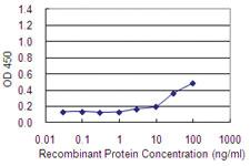 Anti-MAGEA2 Mouse Monoclonal Antibody [clone: 1B1]