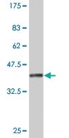 Anti-RUNX2 Mouse Monoclonal Antibody [clone: 1C10]