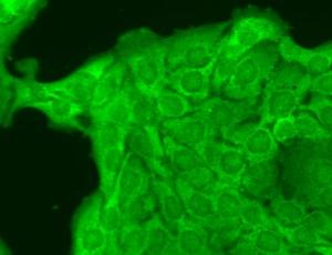 Immunocytochemistry/Immunofluorescence analysis of human HaCaT cells, fixed in cold 100% methanol for 10 minutes at -20°C, using Anti-Nav1