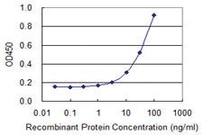 Anti-TK1 Mouse Monoclonal Antibody [clone: 1D10]