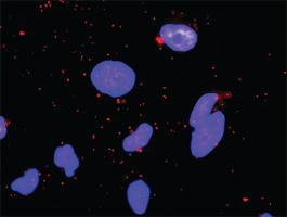 Anti-CDKN1A + CREBBP Antibody Pair