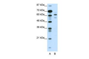 Anti-ZSCAN2 Rabbit Polyclonal Antibody