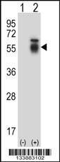 Anti-ACVR1 Rabbit Polyclonal Antibody (HRP (Horseradish Peroxidase))