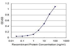 Anti-PRKRIP1 Mouse Monoclonal Antibody [clone: M1]