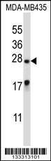 Anti-MEA1 Rabbit Polyclonal Antibody (HRP (Horseradish Peroxidase))