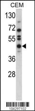 Anti-USP12 Rabbit Polyclonal Antibody