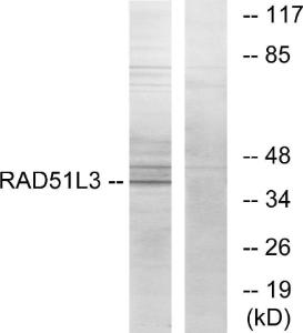 Western blot analysis of lysates from Jurkat cells using Anti-RAD51L3 Antibody. The right hand lane represents a negative control, where the Antibody is blocked by the immunising peptide