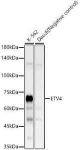 Western blot analysis of variou