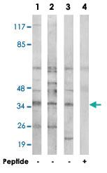 Anti-NEURL2 Rabbit Polyclonal Antibody