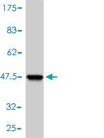 Anti-UBE2A Mouse Monoclonal Antibody [clone: 3D7-E2]