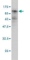 Anti-PRKCI Mouse Monoclonal Antibody [clone: 1G11]