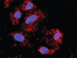 Anti-FAS + PRKCA Antibody Pair