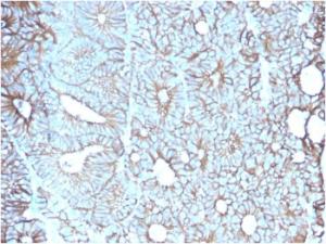 Anti-LI Cadherin Mouse Monoclonal Antibody [clone: CDH17/2617]