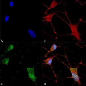 Immunocytochemistry/Immunofluorescence analysis of human neuroblastoma cells (SH-SY5Y), fixed in 4% PFA for 15 min, using Anti-Neuroligin 1 Antibody [S97A-31] (A304803), at 1:100 for overnight at 4 °C with slow rocking