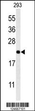 Anti-CD79A Rabbit Polyclonal Antibody