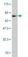 Anti-FLI1 Mouse Monoclonal Antibody [clone: 2G8]