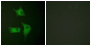 Immunofluorescence analysis of HeLa cells using Anti-p15 INK Antibody. The right hand panel represents a negative control, where the antibody was pre-incubated with the immunising peptide