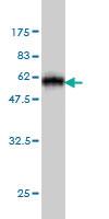 Anti-MTUS1 Mouse Monoclonal Antibody [clone: 1C7]