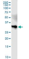 Anti-HS2ST1 Polyclonal Antibody Pair