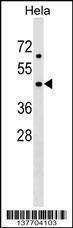 Anti-CERS6 Rabbit Polyclonal Antibody (Biotin)