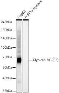 Anti-Glypican 3 antibody