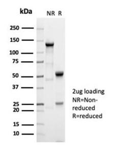 SDS-PAGE analysis of Anti-alpha Fetoprotein Antibody [AFP/7007R] under non-reduced and reduced conditions; showing intact IgG and intact heavy and light chains, respectively. SDS-PAGE analysis confirms the integrity and purity of the antibody.