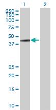 Anti-MAGEA3 Mouse Polyclonal Antibody