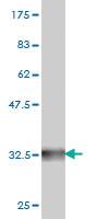 Anti-GNRHR2 Mouse Monoclonal Antibody [clone: 4A5]